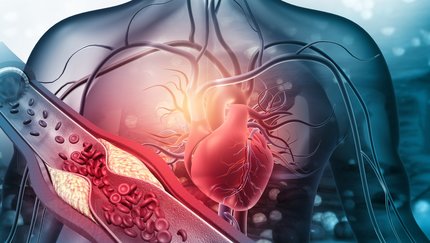 Cardiology in Turkey