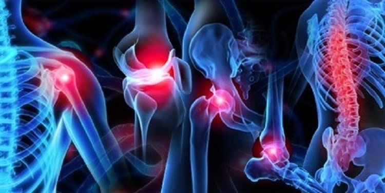 Orthopedics in Turkey