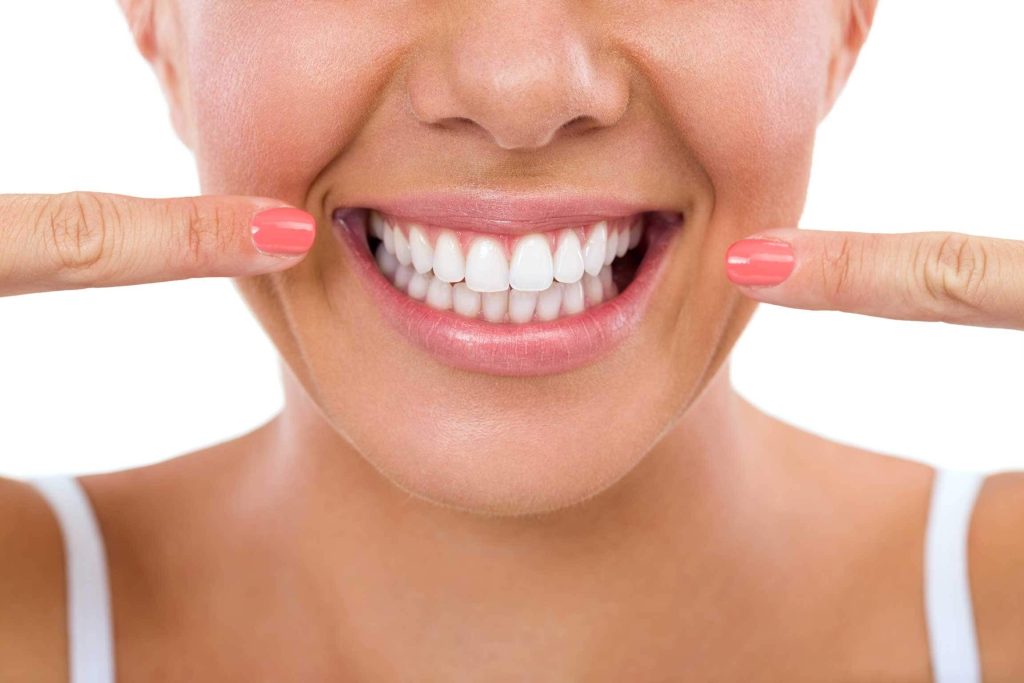 Porcelain Veneers in Turkey